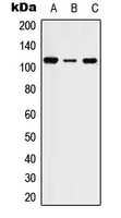 Western blot analysis of STK31 expression in HEK293T (A); SP2/0 (B); PC12 (C) whole cell lysates.