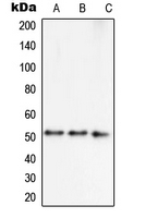Western blot analysis of Septin 7 expression in MCF7 (A); HepG2 (B); NIH3T3 (C) whole cell lysates.