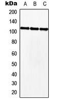 Western blot analysis of MKL2 expression in HEK293T (A); NIH3T3 (B); H9C2 (C) whole cell lysates.