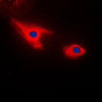 Immunofluorescent analysis of Septin 7 staining in HepG2 cells. Formalin-fixed cells were permeabilized with 0.1% Triton X-100 in TBS for 5-10 minutes and blocked with 3% BSA-PBS for 30 minutes at room temperature. Cells were probed with the primary antibody in 3% BSA-PBS and incubated overnight at 4 C in a humidified chamber. Cells were washed with PBST and incubated with a DyLight 594-conjugated secondary antibody (red) in PBS at room temperature in the dark. DAPI was used to stain the cell nuclei (blue).