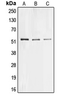 Western blot analysis of Collagen 26 alpha 1 expression in Hela (A); PC12 (B); H9C2 (C) whole cell lysates.