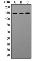 Western blot analysis of ADAR1 expression in Jurkat (A); Ramos (B); HeLa (C) whole cell lysates.