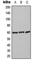 Western blot analysis of Alpha-2C Adrenergic Receptor expression in Jurkat (A); mouse liver (B); rat liver (C) whole cell lysates.