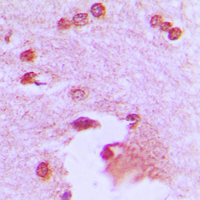 Immunohistochemical analysis of APBA2 staining in human brain formalin fixed paraffin embedded tissue section. The section was pre-treated using heat mediated antigen retrieval with sodium citrate buffer (pH 6.0). The section was then incubated with the antibody at room temperature and detected using an HRP conjugated compact polymer system. DAB was used as the chromogen. The section was then counterstained with haematoxylin and mounted with DPX.