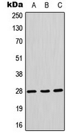 Western blot analysis of Aquaporin 1 expression in A549 (A); mouse liver (B); rat liver (C) whole cell lysates.