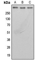 Western blot analysis of BRCA2 expression in MDAMB231 (A); MCF7 (B); rat lung (C) whole cell lysates.