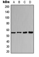 Western blot analysis of CHRNA1 expression in HeLa (A); MCF7 (B); mouse kidney (C); rat liver (D) whole cell lysates.