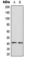 Western blot analysis of CCR4 expression in HL60 (A); MCF7 (B) whole cell lysates.