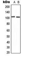 Western blot analysis of CNGB1 expression in U2OS (A); NIH3T3 (B) whole cell lysates.