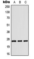 Western blot analysis of Tumstatin expression in HepG2 colchicine-treated (A); HeLa UV-treated (B); Raw264.7 colchicine-treated (C) whole cell lysates.