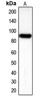 Western blot analysis of KSP Cadherin expression in Caki1 (A) whole cell lysates.