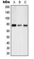 Western blot analysis of ATF6B expression in HepG2 (A); mouse liver (B); rat liver (C) whole cell lysates.