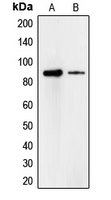 Western blot analysis of Cadherin 18 expression in A549 (A); HeLa (B) whole cell lysates.