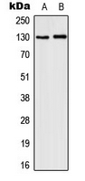 Western blot analysis of CD131 (pY593) expression in MCF7 IL1b-treated (A); HepG2 LPS-treated (B) whole cell lysates.