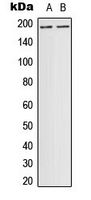 Western blot analysis of DCC expression in ACHN (A) whole cell lysates.