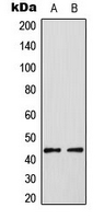 Western blot analysis of NET (pS357) expression in HUVEC PMA-treated (A); HT29 PMA-treated (B) whole cell lysates.