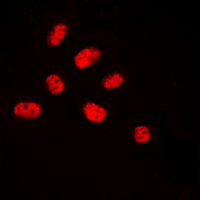 Immunofluorescent analysis of NET (pS357) staining in HUVEC cells. Formalin-fixed cells were permeabilized with 0.1% Triton X-100 in TBS for 5-10 minutes and blocked with 3% BSA-PBS for 30 minutes at room temperature. Cells were probed with the primary antibody in 3% BSA-PBS and incubated overnight at 4 C in a humidified chamber. Cells were washed with PBST and incubated with a DyLight 594-conjugated secondary antibody (red) in PBS at room temperature in the dark. DAPI was used to stain the cell nuclei (blue).