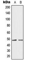 Western blot analysis of GATA4 expression in HepG2 (A); HeLa (B) whole cell lysates.