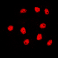 Immunofluorescent analysis of GATA4 staining in HepG2 cells. Formalin-fixed cells were permeabilized with 0.1% Triton X-100 in TBS for 5-10 minutes and blocked with 3% BSA-PBS for 30 minutes at room temperature. Cells were probed with the primary antibody in 3% BSA-PBS and incubated overnight at 4 C in a humidified chamber. Cells were washed with PBST and incubated with a DyLight 594-conjugated secondary antibody (red) in PBS at room temperature in the dark. DAPI was used to stain the cell nuclei (blue).