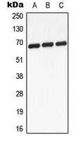 Western blot analysis of GCKR expression in A431 (A); mouse heart (B); PC12 (C) whole cell lysates.