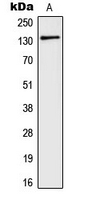Western blot analysis of mGLUR5 expression in A549 (A) whole cell lysates.