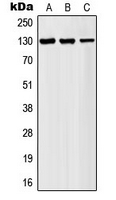 Western blot analysis of AF4 expression in HeLa (A); K562 (B); Jurkat (C) whole cell lysates.