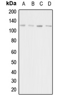 Western blot analysis of Adenylate Cyclase 1 expression in HeLa (A); HEK293T (B); mouse liver (C); rat kidney (D) whole cell lysates.