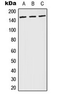 Western blot analysis of PLC gamma 1 (pY783) expression in Jurkat pervanadate-treated (A); NIH3T3 LPS-treated (B); PC12 H2O2-treated (C) whole cell lysates.