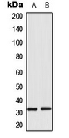 Western blot analysis of RPS6 (pS235) expression in HeLa Calyculin A-treated (A); NIH3T3 (B) whole cell lysates.