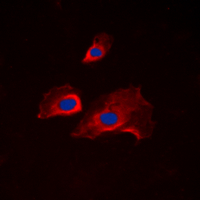 Immunofluorescent analysis of RPS6 (pS235) staining in NIH3T3 cells. Formalin-fixed cells were permeabilized with 0.1% Triton X-100 in TBS for 5-10 minutes and blocked with 3% BSA-PBS for 30 minutes at room temperature. Cells were probed with the primary antibody in 3% BSA-PBS and incubated overnight at 4 C in a humidified chamber. Cells were washed with PBST and incubated with a DyLight 594-conjugated secondary antibody (red) in PBS at room temperature in the dark. DAPI was used to stain the cell nuclei (blue).