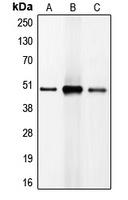 Western blot analysis of C/EBP beta expression in HeLa (A); NIH3T3 (B); Jurkat (C) whole cell lysates.