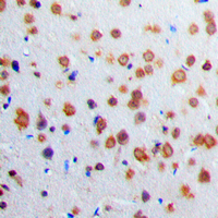 Immunohistochemical analysis of Adenylate Cyclase 1 staining in human brain formalin fixed paraffin embedded tissue section. The section was pre-treated using heat mediated antigen retrieval with sodium citrate buffer (pH 6.0). The section was then incubated with the antibody at room temperature and detected using an HRP conjugated compact polymer system. DAB was used as the chromogen. The section was then counterstained with haematoxylin and mounted with DPX.