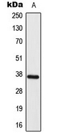 Western blot analysis of ELOVL4 expression in HY926 (A) whole cell lysates.