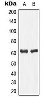 Western blot analysis of PLA2G4C expression in Jurkat (A); human pancreas (B) whole cell lysates.