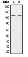 Western blot analysis of HGS expression in H1299 (A); HeLa (B) whole cell lysates.