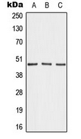Western blot analysis of AKAP5 expression in MDAMB231 (A); NIH3T3 (B); H9C2 (C) whole cell lysates.