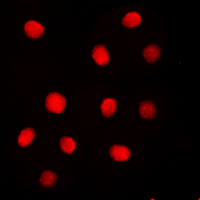 Immunofluorescent analysis of Separase (pS801) staining in MDAMB231 cells. Formalin-fixed cells were permeabilized with 0.1% Triton X-100 in TBS for 5-10 minutes and blocked with 3% BSA-PBS for 30 minutes at room temperature. Cells were probed with the primary antibody in 3% BSA-PBS and incubated overnight at 4 C in a humidified chamber. Cells were washed with PBST and incubated with a DyLight 594-conjugated secondary antibody (red) in PBS at room temperature in the dark. DAPI was used to stain the cell nuclei (blue).