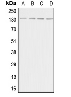 Western blot analysis of Adenylate Cyclase 5/6 expression in HeLa (A); Raw264.7 (B); PC12 (C); rat brain (D) whole cell lysates.