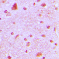 Immunohistochemical analysis of ARNT2 staining in human brain formalin fixed paraffin embedded tissue section. The section was pre-treated using heat mediated antigen retrieval with sodium citrate buffer (pH 6.0). The section was then incubated with the antibody at room temperature and detected using an HRP conjugated compact polymer system. DAB was used as the chromogen. The section was then counterstained with haematoxylin and mounted with DPX.
