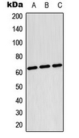 Western blot analysis of TESK2 expression in Raji (A); HepG2 (B); NIH3T3 (C) whole cell lysates.