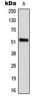 Western blot analysis of CD2BP2 expression in HeLa (A) whole cell lysates.