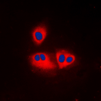 Immunofluorescent analysis of ACOT2 staining in K562 cells. Formalin-fixed cells were permeabilized with 0.1% Triton X-100 in TBS for 5-10 minutes and blocked with 3% BSA-PBS for 30 minutes at room temperature. Cells were probed with the primary antibody in 3% BSA-PBS and incubated overnight at 4 C in a humidified chamber. Cells were washed with PBST and incubated with a DyLight 594-conjugated secondary antibody (red) in PBS at room temperature in the dark. DAPI was used to stain the cell nuclei (blue).
