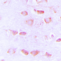 Immunohistochemical analysis of Histamine H3 Receptor staining in human brain formalin fixed paraffin embedded tissue section. The section was pre-treated using heat mediated antigen retrieval with sodium citrate buffer (pH 6.0). The section was then incubated with the antibody at room temperature and detected using an HRP conjugated compact polymer system. DAB was used as the chromogen. The section was then counterstained with haematoxylin and mounted with DPX.