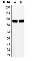 Western blot analysis of ZHX2 expression in HepG2 (A); K562 (B) whole cell lysates.
