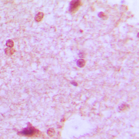 Immunohistochemical analysis of ZHX2 staining in human brain formalin fixed paraffin embedded tissue section. The section was pre-treated using heat mediated antigen retrieval with sodium citrate buffer (pH 6.0). The section was then incubated with the antibody at room temperature and detected using an HRP conjugated compact polymer system. DAB was used as the chromogen. The section was then counterstained with haematoxylin and mounted with DPX.