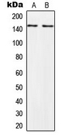 Western blot analysis of PALLD expression in HeLa (A); PC3 (B) whole cell lysates.