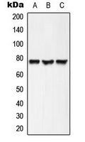 Western blot analysis of ACSL6 expression in HepG2 (A); mouse brain (B); rat brain (C) whole cell lysates.