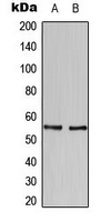Western blot analysis of HBP1 expression in SKBR3 (A); U937 (B) whole cell lysates.