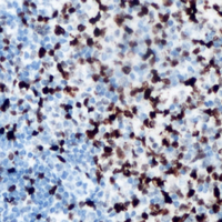 Immunohistochemical analysis of ANKRD1 staining in human lymph node formalin fixed paraffin embedded tissue section. The section was pre-treated using heat mediated antigen retrieval with sodium citrate buffer (pH 6.0). The section was then incubated with the antibody at room temperature and detected using an HRP conjugated compact polymer system. DAB was used as the chromogen. The section was then counterstained with haematoxylin and mounted with DPX.
