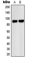 Western blot analysis of PNPLA8 expression in A549 (A); HeLa (B) whole cell lysates.